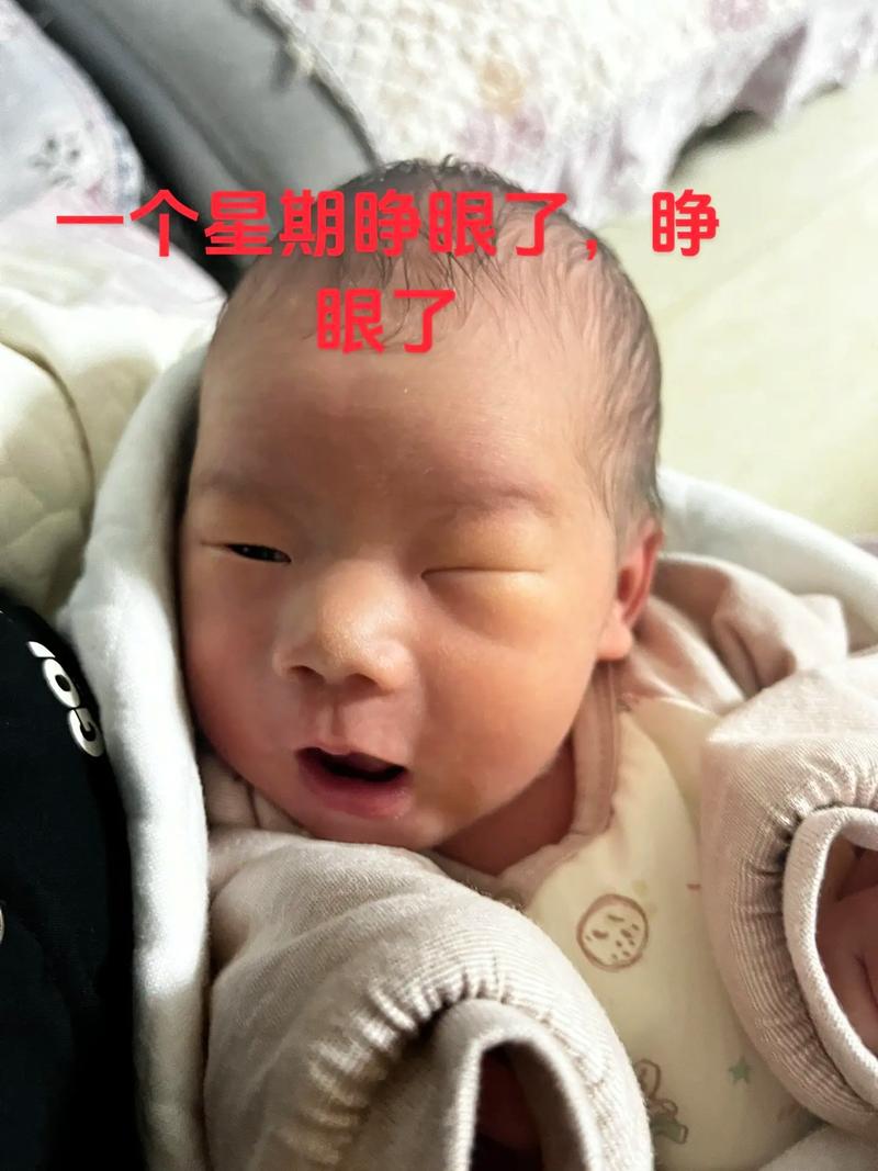新生儿宝宝睁眼不睡觉是正常现象还是身体不适？-第1张图片-郑州医学网