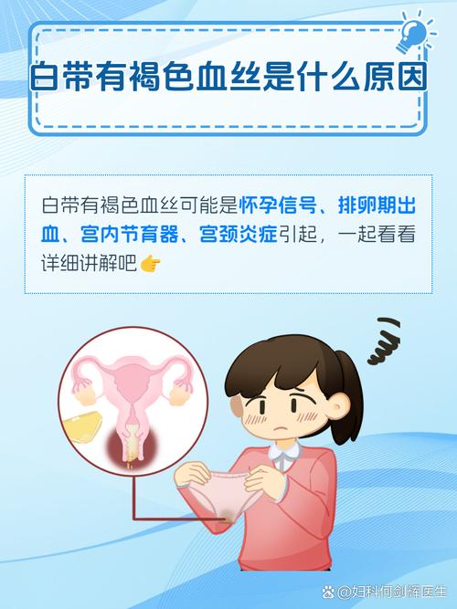 孕期白带出现血丝是危险信号吗？需要立即就医吗？-第3张图片-郑州医学网
