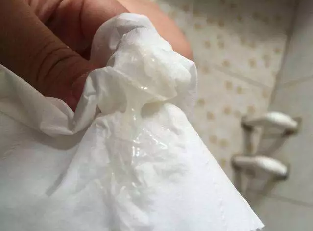 孕期阴道流出黄色液体是感染信号吗？对胎儿有影响吗？-第1张图片-郑州医学网