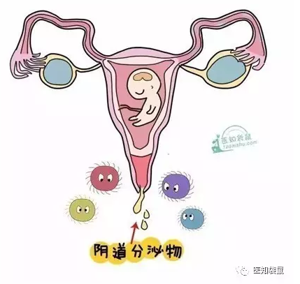 孕期阴道流出黄色液体是感染信号吗？对胎儿有影响吗？-第2张图片-郑州医学网