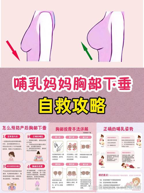 孕期乳房下垂风险高，有哪些科学方法能有效预防？-第1张图片-郑州医学网