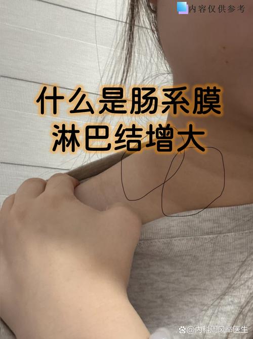 儿童肠结节有哪些典型症状?家长如何早期发现与应对?-第3张图片-郑州医学网 儿童肠结节有哪些典型症状?家长如何早期发现与应对?-第3张图片-郑州医学网