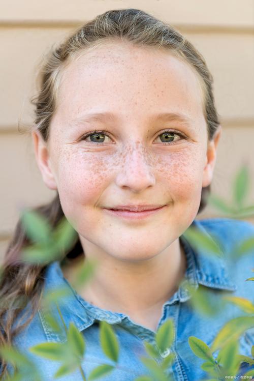 儿童长雀斑必须治疗吗？不治疗会加重吗？有哪些安全有效的办法？-第3张图片-郑州医学网