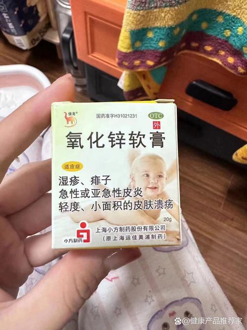 儿童脸部过敏用药，到底该如何选择才安全有效？-第1张图片-郑州医学网