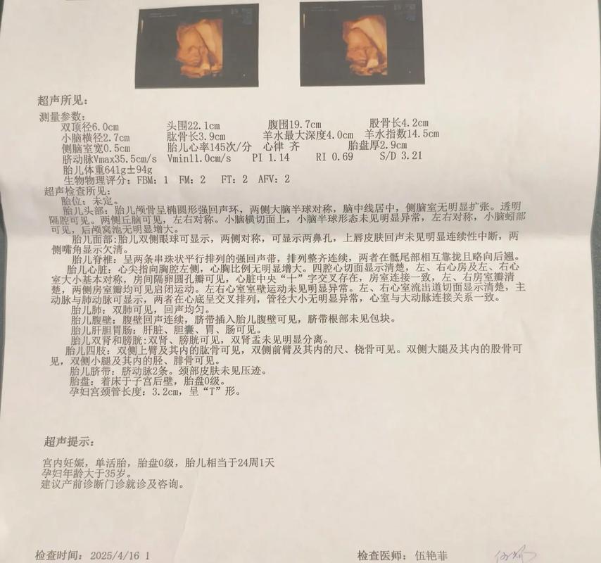 怀孕期间要做几次四维-第1张图片-郑州医学网