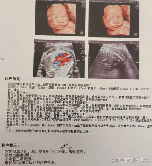 怀孕期间要做几次四维-第3张图片-郑州医学网
