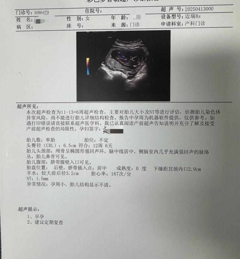 孕期三个月后，每次产检都查哪些项目？这些检查对胎儿和孕妇有多重要？-第1张图片-郑州医学网