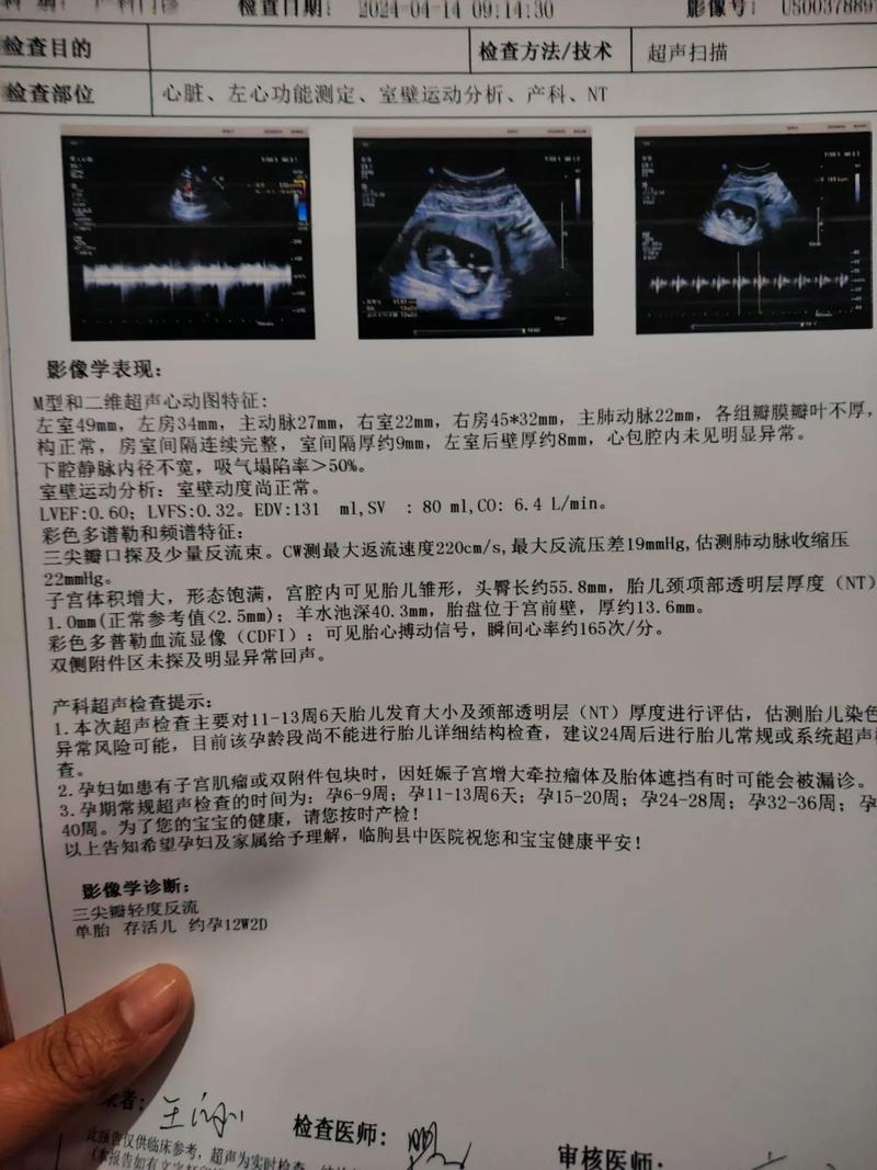 孕期三个月后，每次产检都查哪些项目？这些检查对胎儿和孕妇有多重要？-第2张图片-郑州医学网