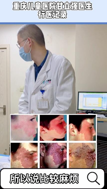 河北省儿童医院皮肤科擅长治疗哪些儿童常见及疑难皮肤问题？-第3张图片-郑州医学网