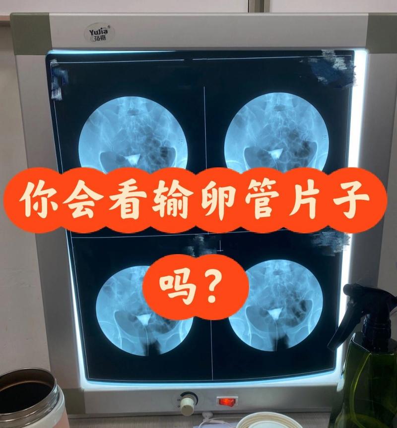 备孕期间意外拍了X片,孩子还能要吗?辐射影响有多大?-第1张图片-郑州医学网 备孕期间意外拍了X片,孩子还能要吗?辐射影响有多大?-第1张图片-郑州医学网