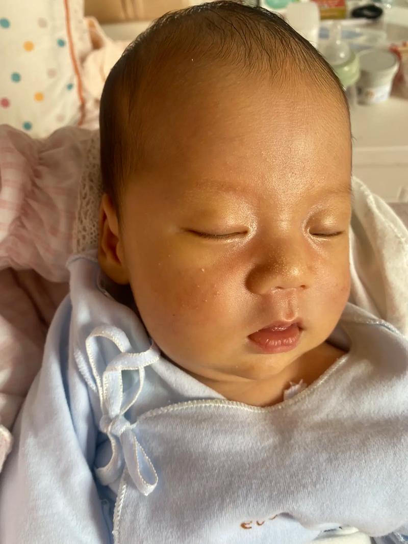 两个月新生儿脸黄手白是正常生理现象还是健康异常信号？-第1张图片-郑州医学网