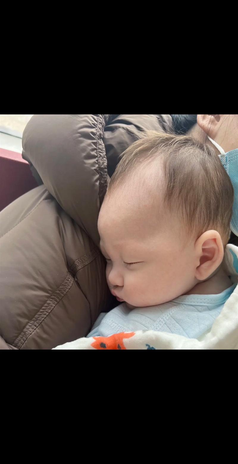 两个月新生儿脸黄手白是正常生理现象还是健康异常信号？-第3张图片-郑州医学网