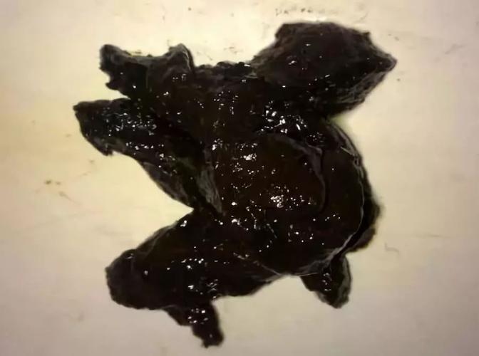 新生儿第一次大便黑色是正常现象还是健康警示？-第1张图片-郑州医学网
