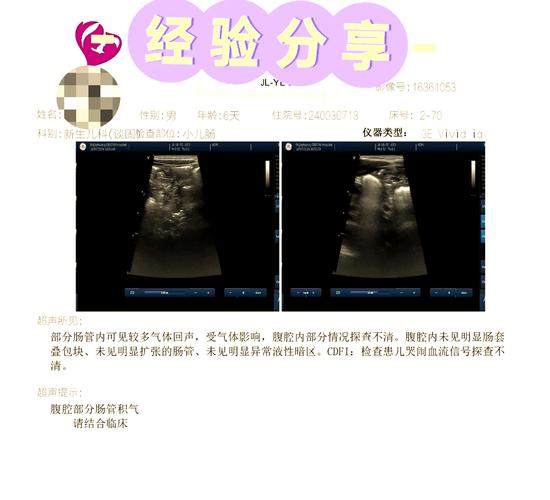 新生儿第一次大便黑色是正常现象还是健康警示？-第3张图片-郑州医学网