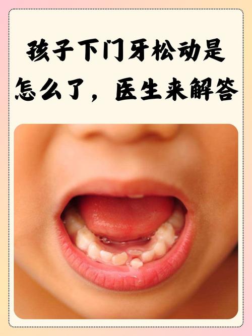 儿童牙齿间隙大是正常现象吗？需要干预吗？会影响后续换牙吗？-第3张图片-郑州医学网