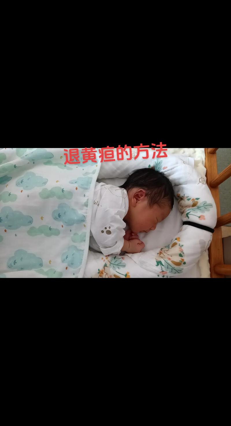 新生儿四个月黄疸不退,是病理性黄疸还是代谢异常?-第3张图片-郑州医学网 新生儿四个月黄疸不退,是病理性黄疸还是代谢异常?-第3张图片-郑州医学网