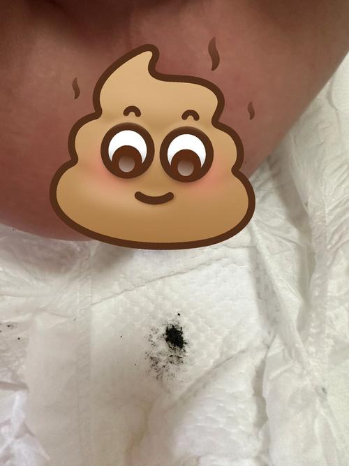 新生儿第一次大便为什么一直没来?新手爸妈该如何应对?-第1张图片-郑州医学网 新生儿第一次大便为什么一直没来?新手爸妈该如何应对?-第1张图片-郑州医学网