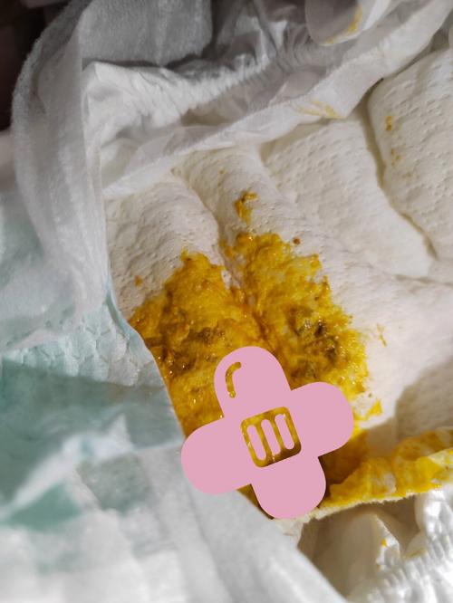 新生儿频繁拉粑粑是正常生理现象还是消化异常信号？-第2张图片-郑州医学网