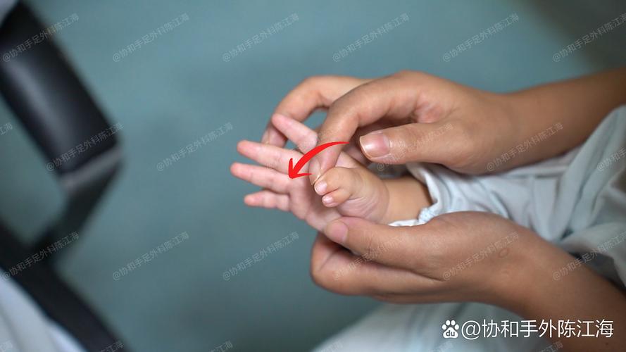 新生儿一惊一乍手乱抓-第1张图片-郑州医学网
