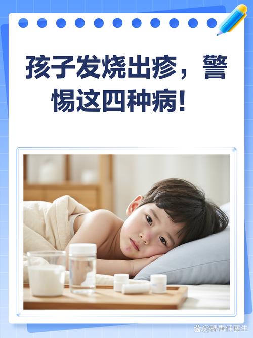 儿童病毒性发烧的症状-第2张图片-郑州医学网