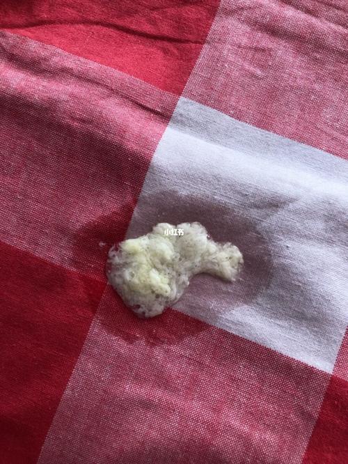 新生儿吐豆腐渣样物是消化问题还是感染信号?-第1张图片-郑州医学网 新生儿吐豆腐渣样物是消化问题还是感染信号?-第1张图片-郑州医学网