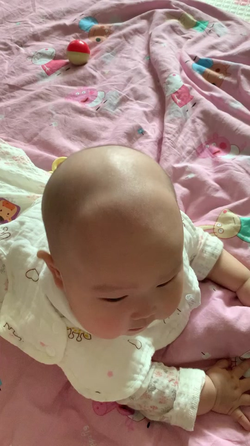 新生儿两侧头凹凸不平是正常现象吗?需要警惕哪些潜在问题?-第3张图片-郑州医学网 新生儿两侧头凹凸不平是正常现象吗?需要警惕哪些潜在问题?-第3张图片-郑州医学网