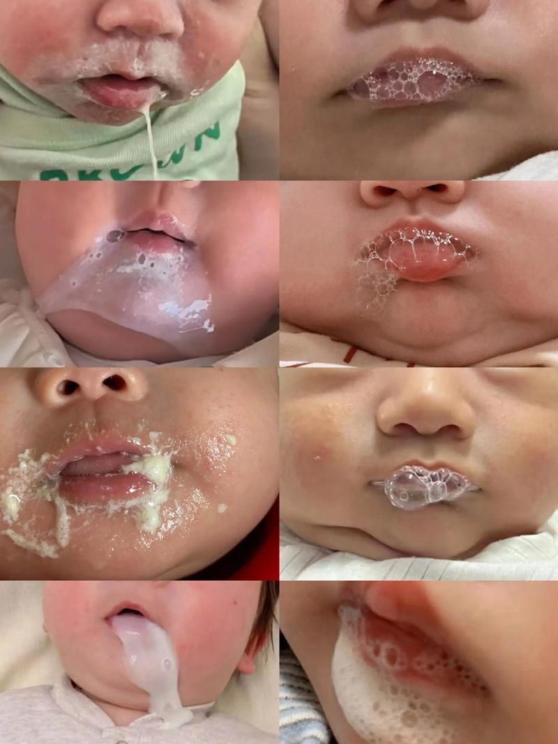 新生儿一天干呕很多次是正常现象还是健康预警？需警惕哪些潜在问题？-第2张图片-郑州医学网