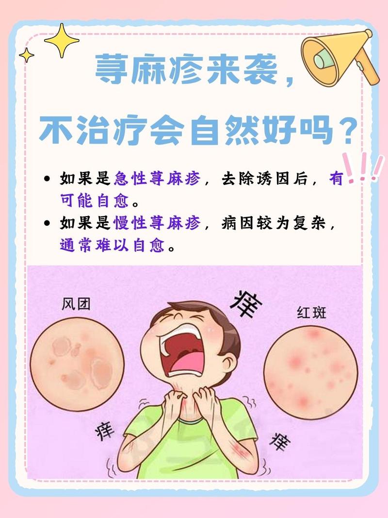 儿童荨麻疹频发,究竟哪些隐形推手在悄悄作祟?-第3张图片-郑州医学网 儿童荨麻疹频发,究竟哪些隐形推手在悄悄作祟?-第3张图片-郑州医学网