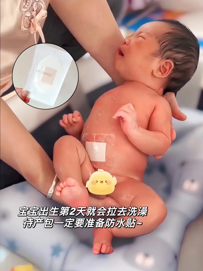 新生儿第二天没有小便正常吗？需要担心哪些问题？-第3张图片-郑州医学网