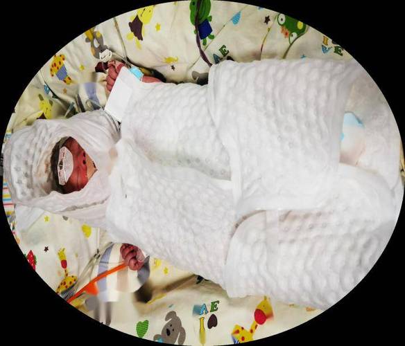 新生儿窘迫后遗症三级，如何科学干预与家庭护理？-第2张图片-郑州医学网