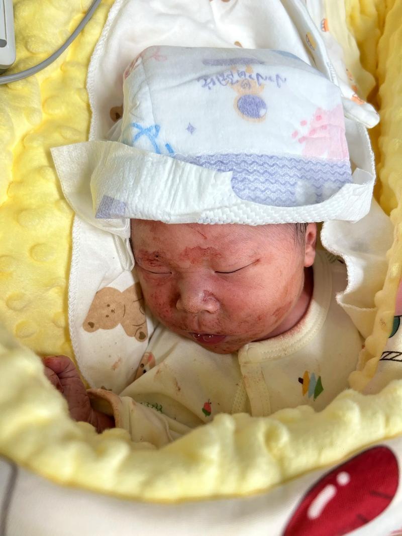 新生儿窘迫后遗症三级，如何科学干预与家庭护理？-第3张图片-郑州医学网