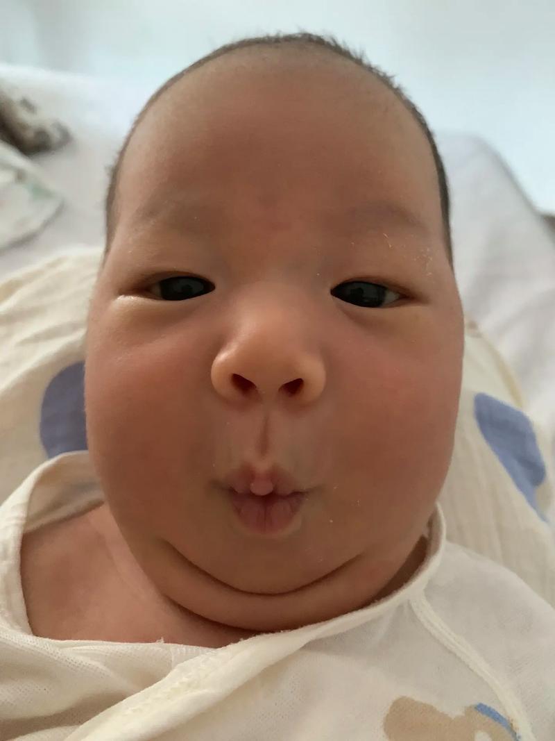 新生儿为何天生呈现三角嘴形状？是发育特征还是异常信号？-第1张图片-郑州医学网