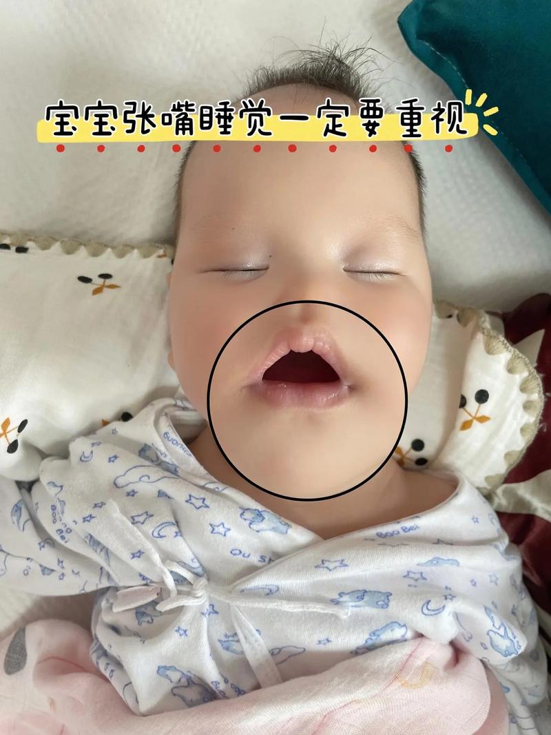 新生儿为何天生呈现三角嘴形状？是发育特征还是异常信号？-第3张图片-郑州医学网