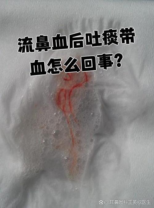 孕期鼻子和喉咙总出血，是正常生理反应还是危险信号？-第1张图片-郑州医学网