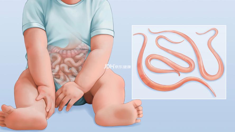 儿童肚子有蛔虫会出现哪些典型症状?家长该如何辨别和应对?-第1张图片-郑州医学网 儿童肚子有蛔虫会出现哪些典型症状?家长该如何辨别和应对?-第1张图片-郑州医学网