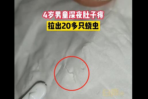 儿童肚子有蛔虫会出现哪些典型症状？家长该如何辨别和应对？-第2张图片-郑州医学网