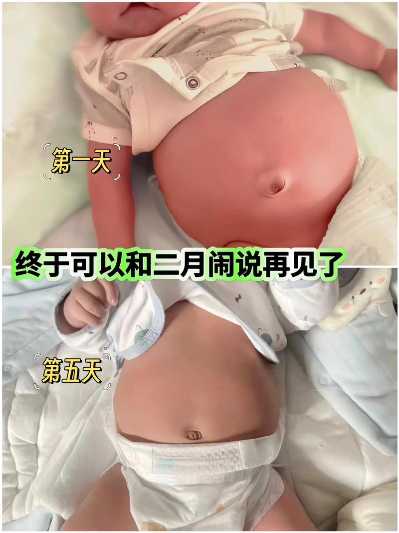 新生儿20天会攒肚吗？攒肚是正常发育信号还是消化异常表现？-第3张图片-郑州医学网