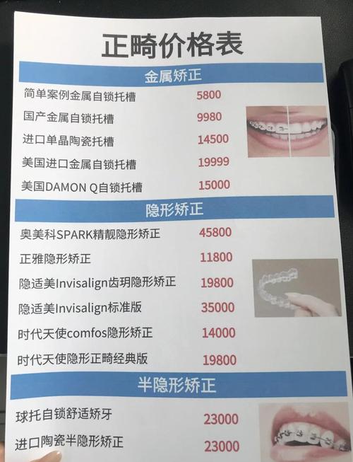 上海儿童牙齿矫正费用到底多少？不同方案差异大吗？医保能报销吗？-第2张图片-郑州医学网