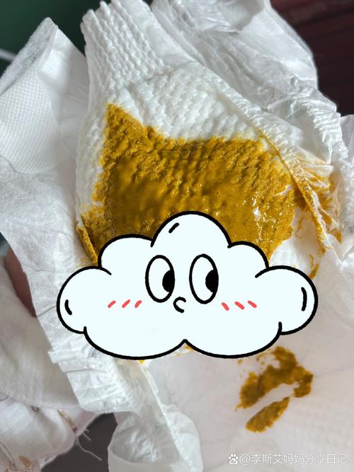 新生儿三天没大便，是攒肚还是便秘？需要干预吗？-第2张图片-郑州医学网