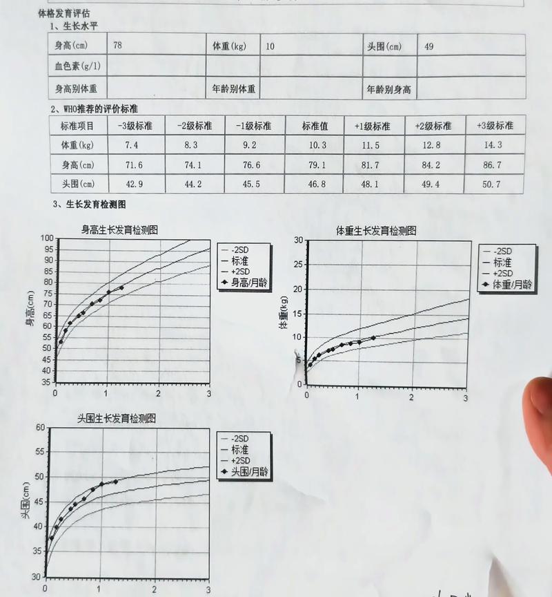 新生儿第一次体检都查哪些项目？家长需要提前做哪些准备？-第3张图片-郑州医学网