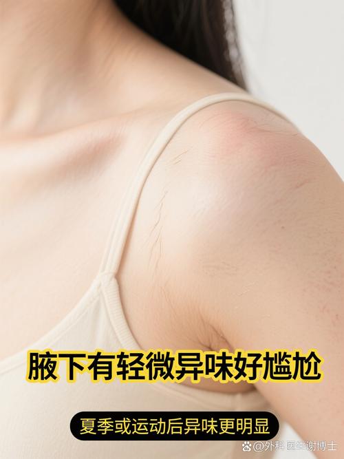 孕期腋下异味是激素变化还是代谢异常？该怎么护理才安心？-第3张图片-郑州医学网