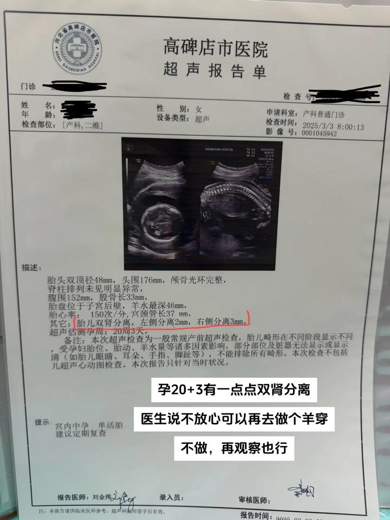 孕期双肾集合系统分离会自行消失吗？对胎儿发育有影响吗？需要治疗吗？-第3张图片-郑州医学网