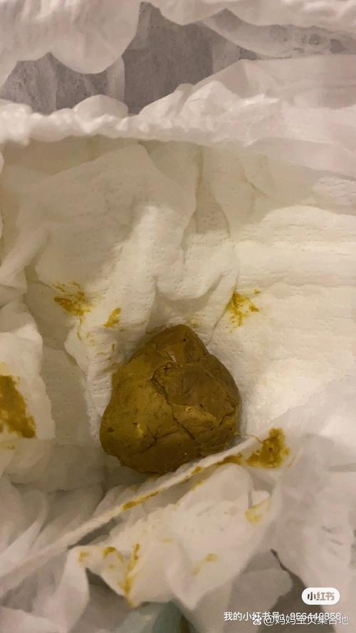 6天新生儿两天未大便，是正常攒肚还是需警惕的便秘信号？-第2张图片-郑州医学网