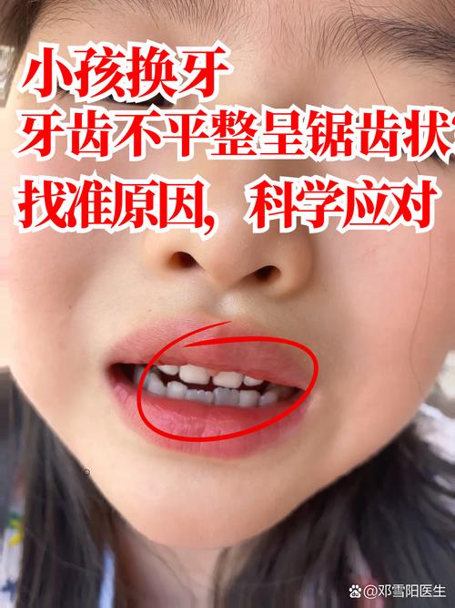 五岁半换牙算早还是晚？换牙顺序异常需要担心吗？-第1张图片-郑州医学网