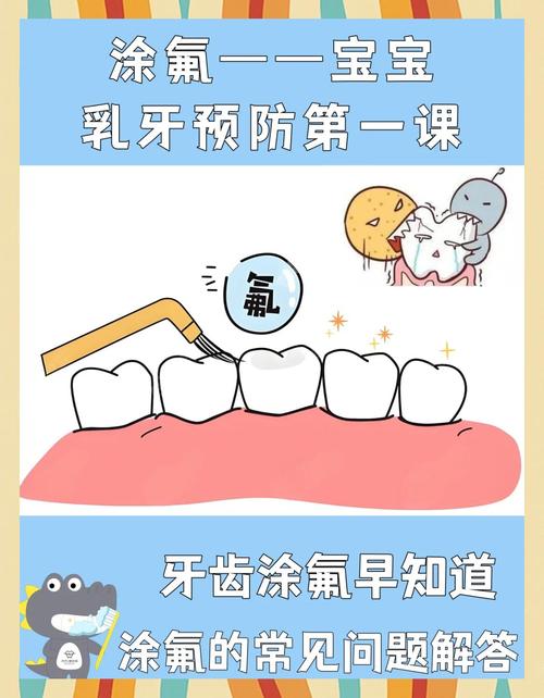 儿童牙齿涂氟有哪些注意事项？家长必知的5个关键点！-第2张图片-郑州医学网