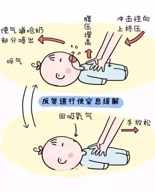 新生儿口鼻呛奶时家长该如何正确急救与后续护理？-第2张图片-郑州医学网