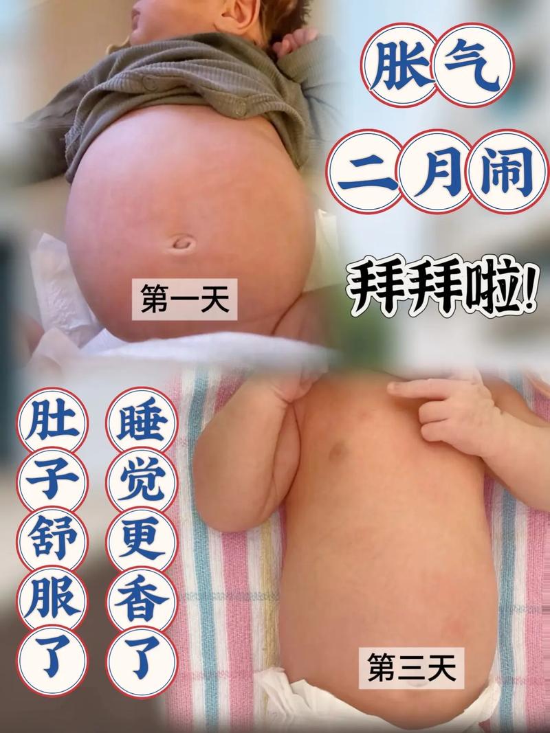 十天新生儿睡觉不踏实，是正常现象还是需要警惕的健康信号？-第2张图片-郑州医学网