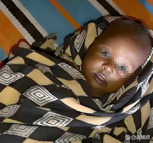 新生儿脸怎么越来越黑？是正常现象还是健康信号？需要干预吗？-第1张图片-郑州医学网