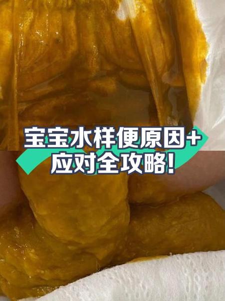 新生儿闪腰拉什么样便-第1张图片-郑州医学网