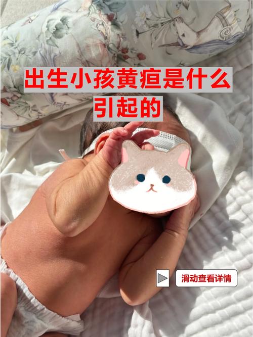 新生儿出生第三天黄疸值偏高需要干预吗？-第3张图片-郑州医学网
